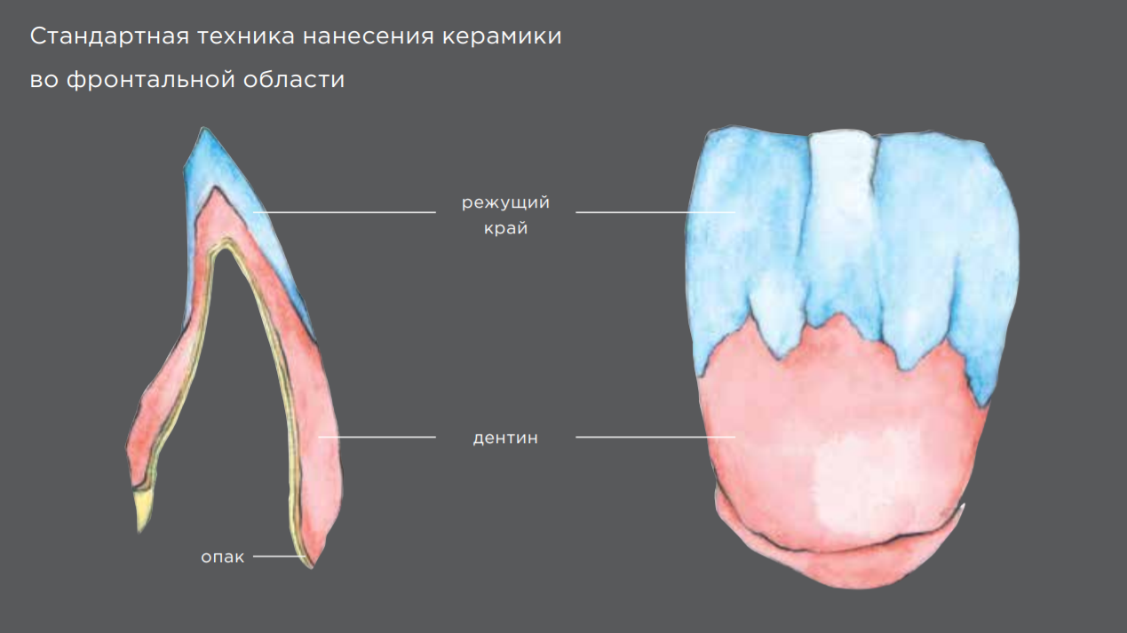 Схема нанесения керамики